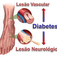 pe-diabetico-lesao